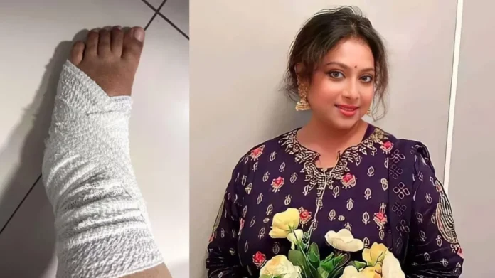 রাস্তায় পড়ে গিয়ে আহত শাবনূর, পায়ে প্লাস্টার
