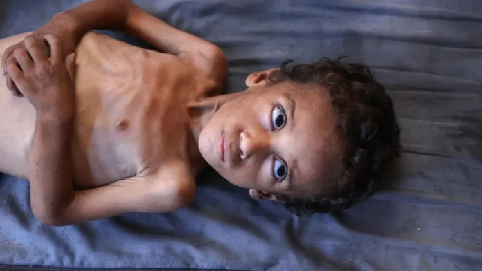 গাজায় মানবসৃষ্ট দুর্ভিক্ষে মৃত্যু বাড়ছে, সতর্ক করল ডব্লিউএইচও