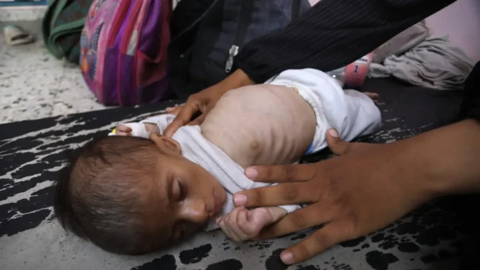 গাজায় মানবিক বিপর্যয় বন্ধের আহ্বান ব্রিটেন, ফ্রান্স ও জার্মানির