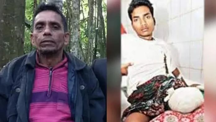 র‍্যাবের গুলিতে পা হারানো লিমনের বাবার ওপর হামলার অভিযোগ