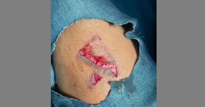 পল্লবী থানায় ককটেল বিস্ফোরণে এএসআই আহত, অজ্ঞাত হামলাকারীদের খুঁজছে পুলিশ